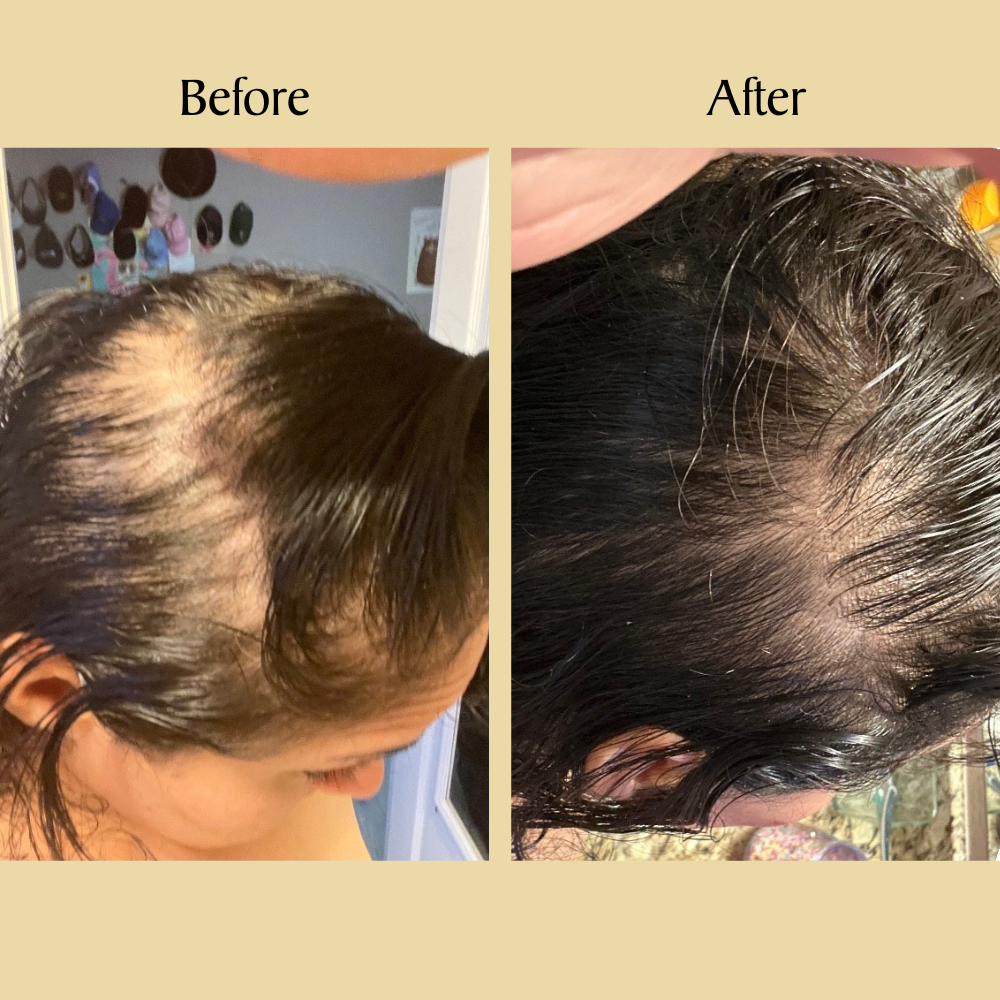Mothers Day Sale -  Natural Hair Growth Oil